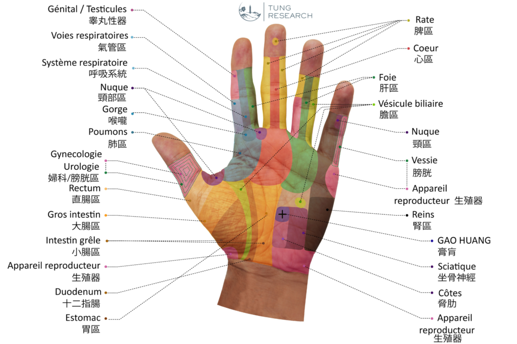 Photo 5 — le diagnostic palmaire du Dr Li Guo-zheng, publié en 2011 dans son étude du diagnostic de l’acupuncture taïwanaise de la famille Tung. Reproduction autorisée par le Dr Li lui-même.