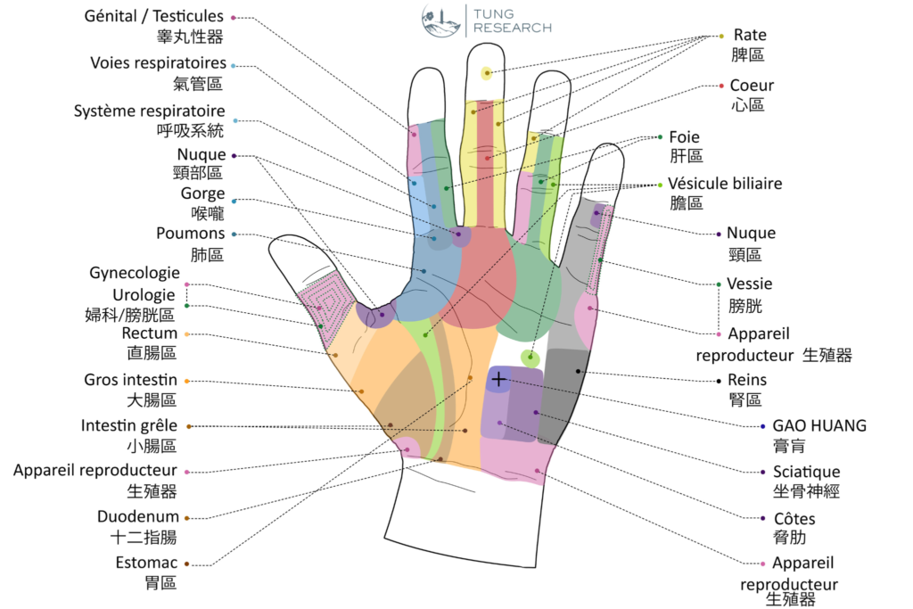 Schéma 5 — le même diagnostic, redessiné. Reproduction autorisée par le Dr Li lui-même.